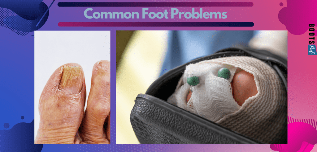 Common foot problems caused by work boots